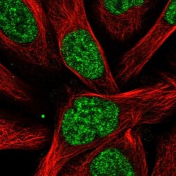 RBM15 Antibody, Novus Biologicals 0.1mL; Unlabeled:Antibodies, Polyclonal